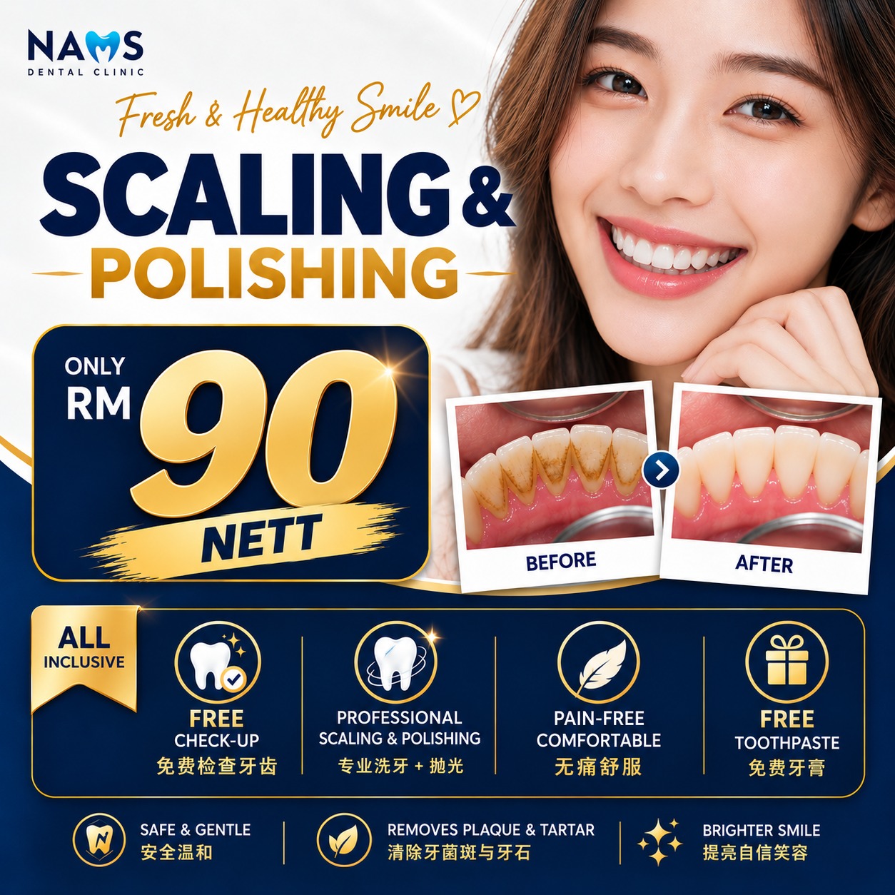 nams scaling polishing promo