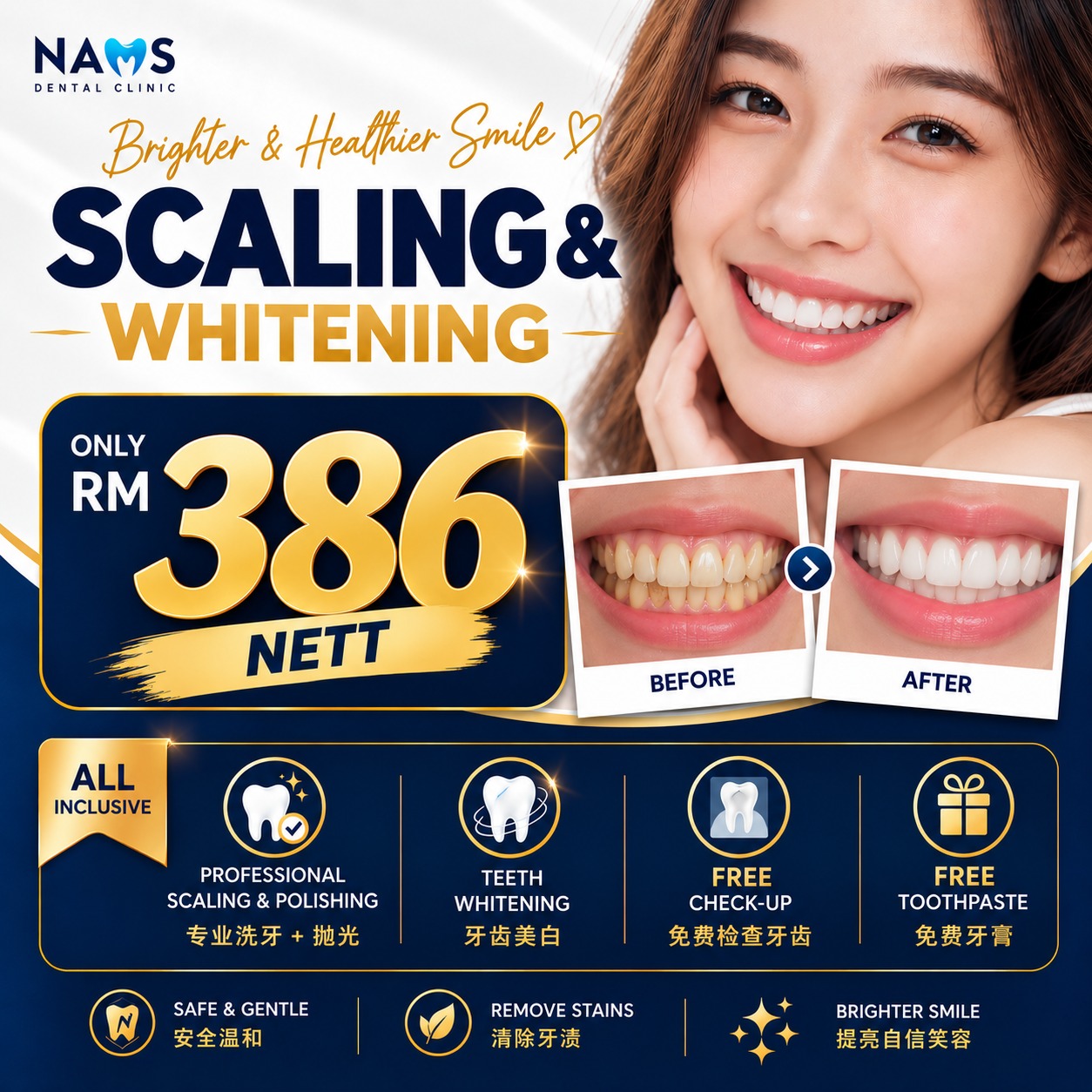 nams scaling